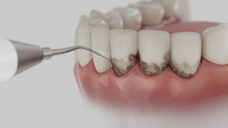Reliable Dental Implants contractor in Surfside, FL by Smile Center Dentistry